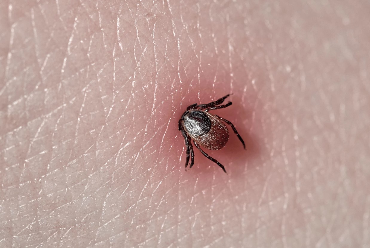 Hvordan kan man beskytte sig mod flåtbid: vigtige regler, man ikke må glemme