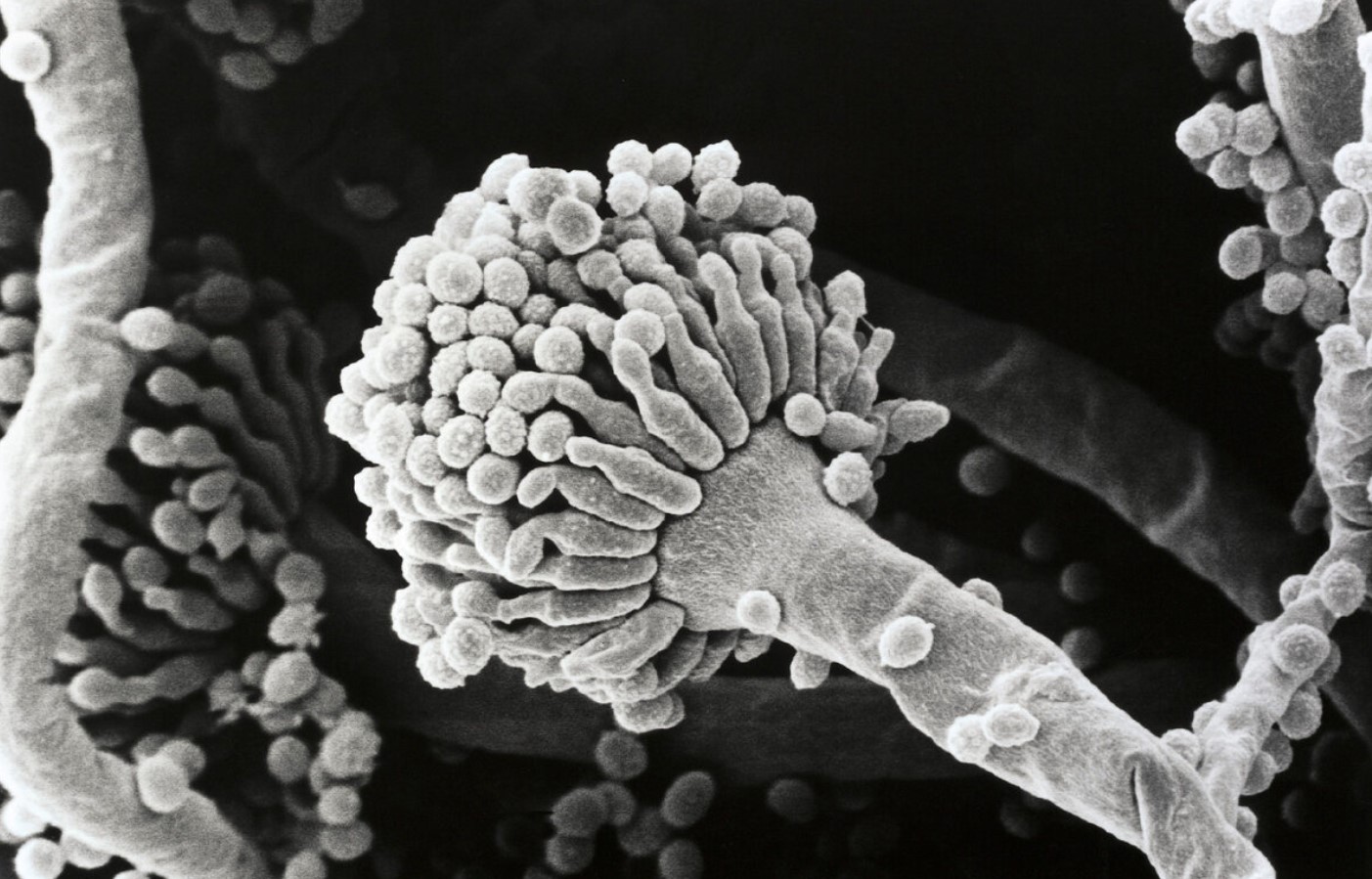 Aspergillus fumigatus