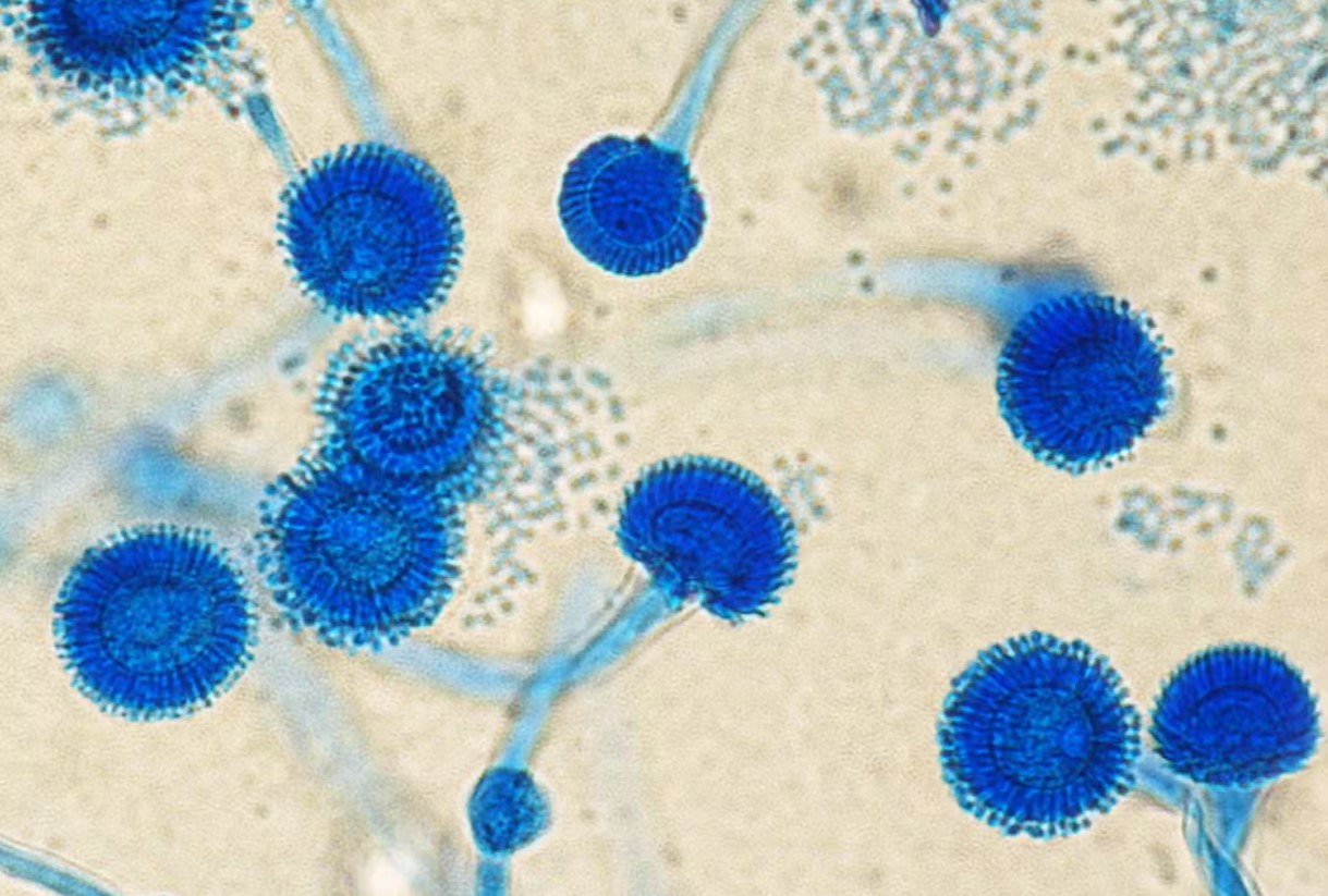 Aspergillus fumigatus