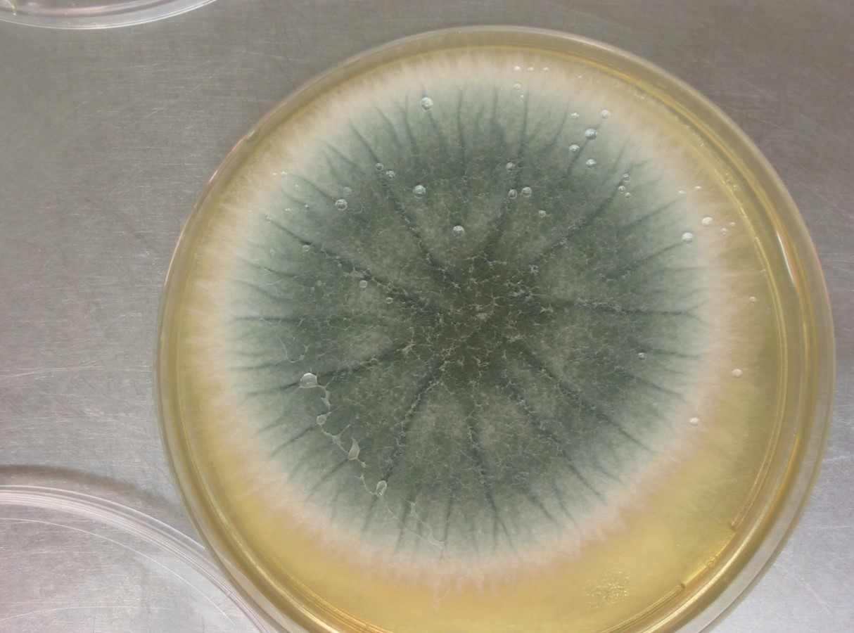 Aspergillus fumigatus