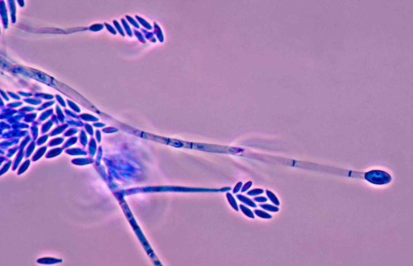 Fusarium xyrophilum