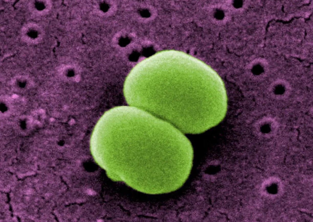 Staphylococcus hominis