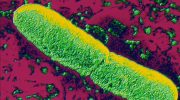 Yersinia pestis