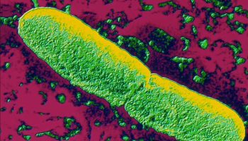 Yersinia pestis