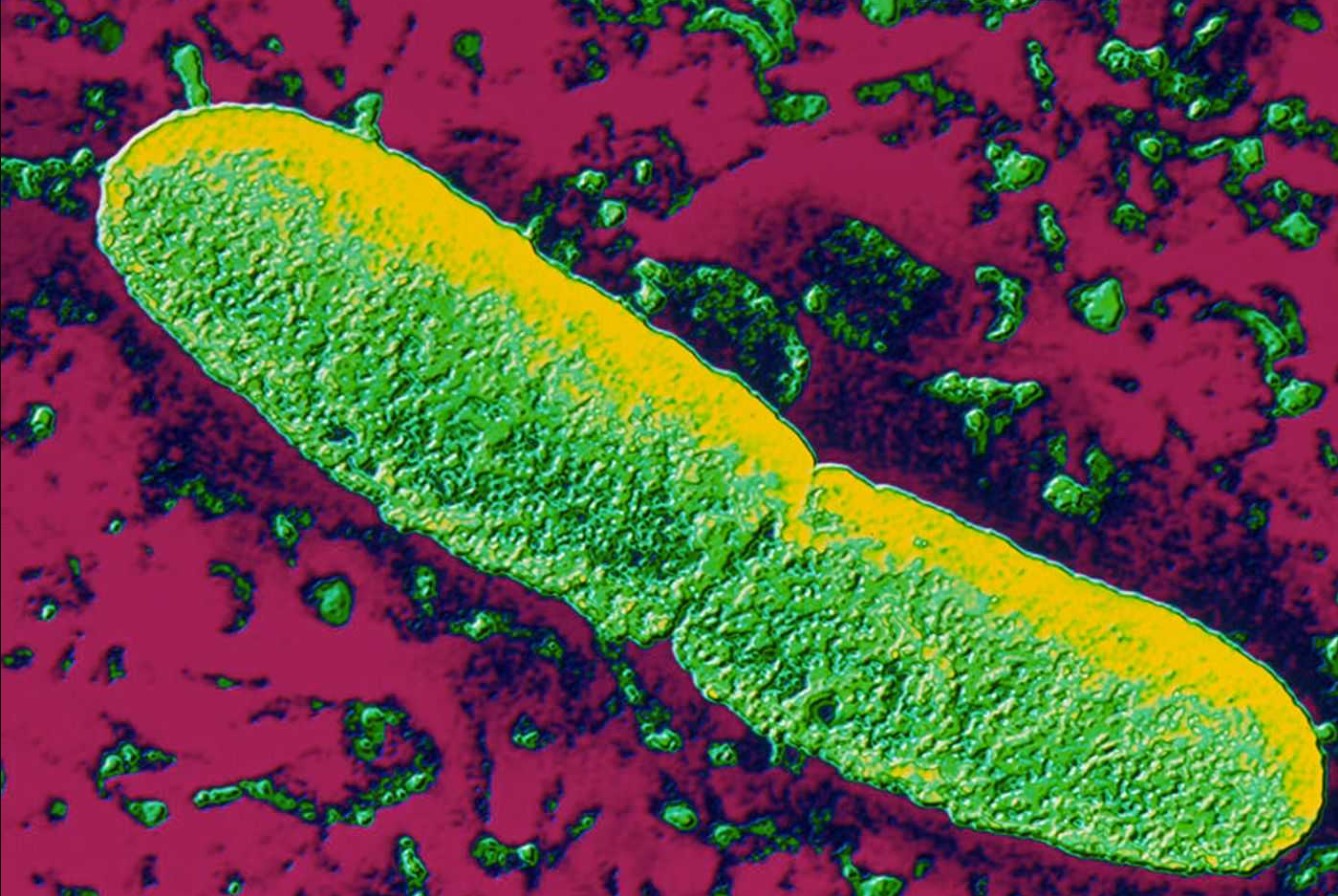 Yersinia pestis