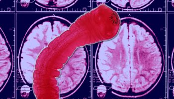 'Jeg er neurolog - 3 fødevarer, jeg ikke vil spise, fordi de kan give dig neurotoksiner eller hjerneparasitter'