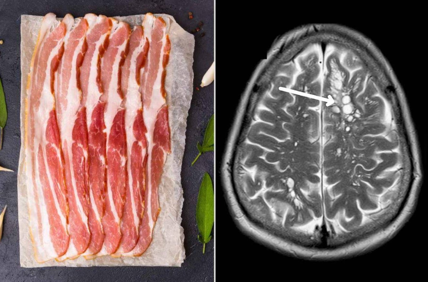'Jeg er neurolog - 3 fødevarer, jeg ikke vil spise, fordi de kan give dig neurotoksiner eller hjerneparasitter'